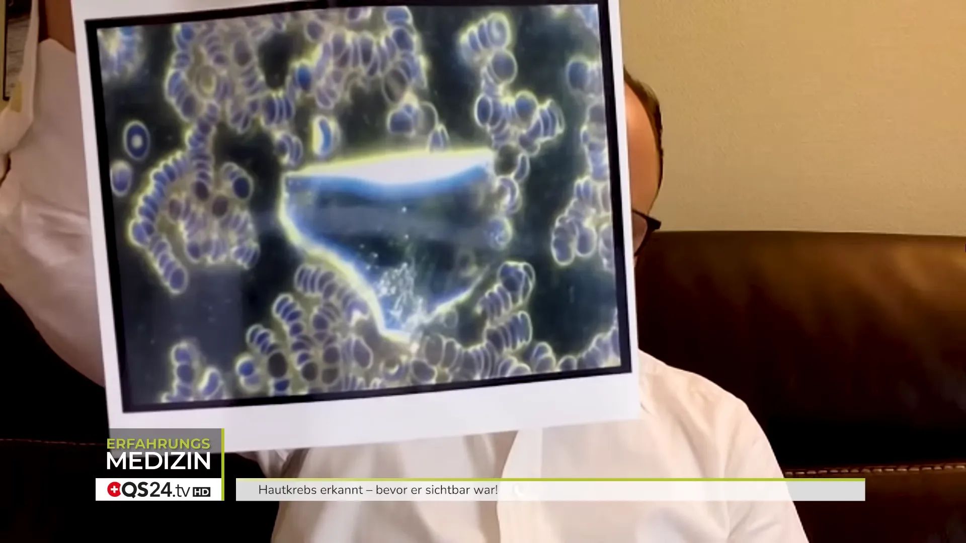 Dunkelfeld nach Therapie: Zellen bereits runder und deutlich verbessert