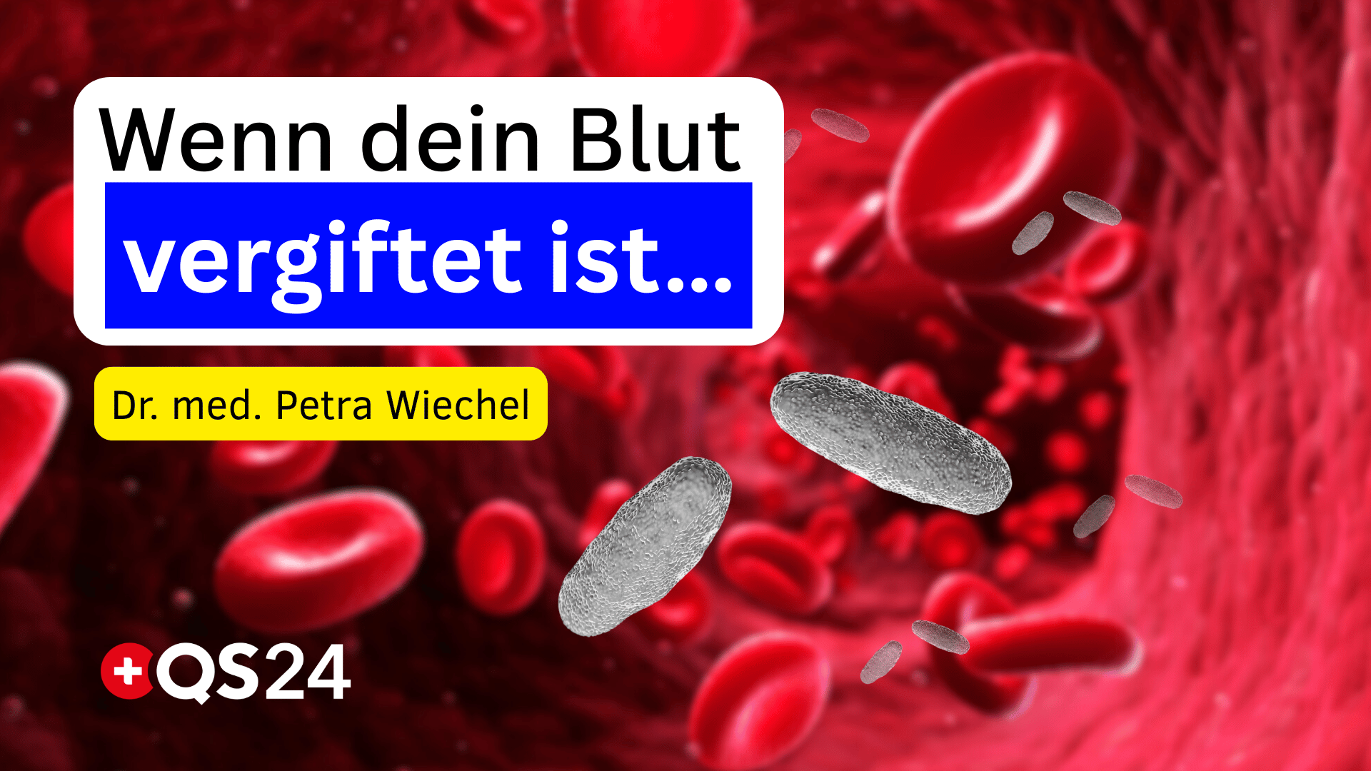 Toxinausleitung über das Blut so funktioniert Hämoadsorption