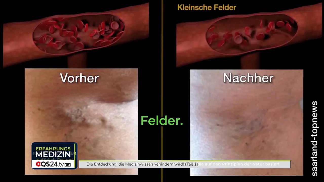 Dunkelfeld-Aufnahmen zeigen verbesserte Fließfähigkeit des Blutes