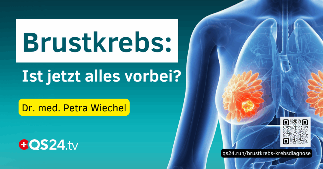 Brustkrebs. Ist jetzt alles vorbei? Umgang mit einer Krebsdiagnose